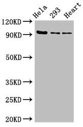MCM4 Antibody - Positive Western Blot detected in Hela whole cell lysate, 293 whole cell lysate, Rat heart tissue. All lanes: MCM4 antibody at 2.7 µg/ml Secondary Goat polyclonal to rabbit IgG at 1/50000 dilution. Predicted band size: 97 KDa. Observed band size: 97 KDa