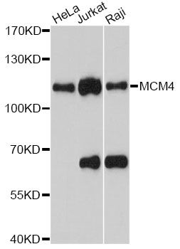 MCM4 Antibody - Western blot analysis of extracts of various cell lines, using MCM4 antibody at 1:1000 dilution. The secondary antibody used was an HRP Goat Anti-Rabbit IgG (H+L) at 1:10000 dilution. Lysates were loaded 25ug per lane and 3% nonfat dry milk in TBST was used for blocking. An ECL Kit was used for detection and the exposure time was 30s.