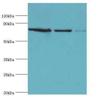 MCM5 Antibody - Western blot. All lanes: DNA replication licensing factor MCM5 antibody at 3 ug/ml. Lane 1: HeLa whole cell lysate. Lane 2: MCF-7 whole cell lysate. Lane 2: mouse thymus tissue. secondary Goat polyclonal to rabbit at 1:10000 dilution. Predicted band size: 82 kDa. Observed band size: 82 kDa.