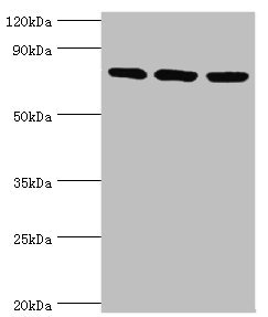 MCM5 Antibody - Western blot All lanes: DNA replication licensing factor MCM5 antibody at 3µg/ml Lane 1: Hela whole cell lysate Lane 2: MCF-7 whole cell lysate Lane 2: Mouse thymus tissue Secondary Goat polyclonal to rabbit IgG at 1/10000 dilution Predicted band size: 82 kDa Observed band size: 82 kDa