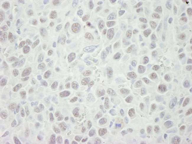 MCM5 Antibody - Detection of Mouse MCM5 by Immunohistochemistry. Sample: FFPE section of mouse squamous cell carcinoma. Antibody: Affinity purified rabbit anti-MCM5 used at a dilution of 1:250. Detection: DAB.