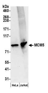 MCM5 Antibody - Detection of human MCM5 by western blot. Samples: Whole cell lysate (50 µg) from HeLa and Jurkat cells prepared using NETN lysis buffer. Antibody: Affinity purified rabbit anti-MCM5 antibody used for WB at 0.05 µg/ml. Detection: Chemiluminescence with an exposure time of 10 seconds.
