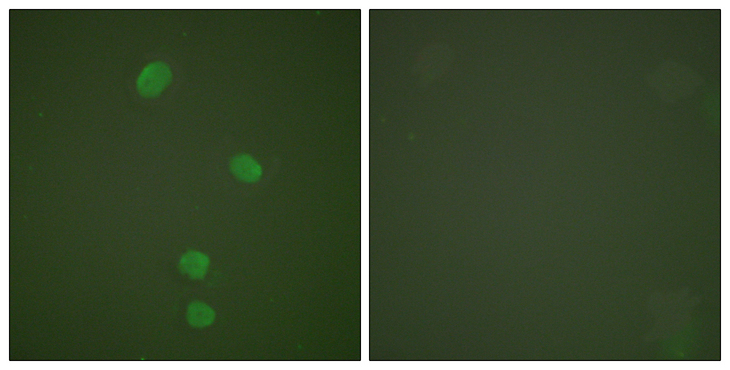 MCM5 Antibody - Immunofluorescence analysis of HepG2 cells, using MCM5 Antibody. The picture on the right is blocked with the synthesized peptide.