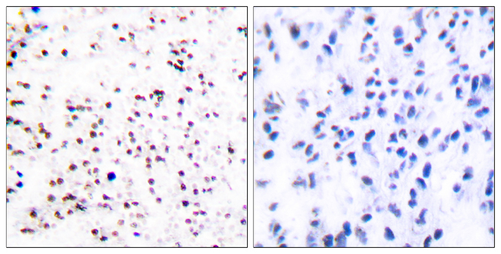 MCM5 Antibody - Immunohistochemistry analysis of paraffin-embedded human tonsil tissue, using MCM5 Antibody. The picture on the right is blocked with the synthesized peptide.