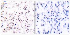 MCM5 Antibody - Immunohistochemistry analysis of paraffin-embedded human tonsil tissue, using MCM5 Antibody. The picture on the right is blocked with the synthesized peptide.
