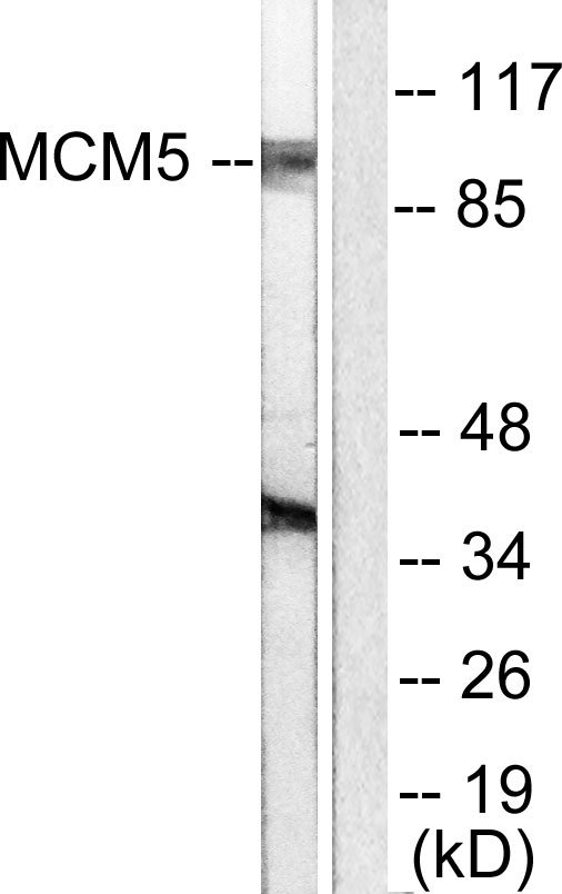 MCM5 Antibody - Western blot analysis of lysates from HepG2 cells, using MCM5 Antibody. The lane on the right is blocked with the synthesized peptide.