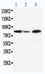 MCM5 Antibody - WB of MCM5 antibody. All lanes: Anti-MCM5 at 0.5ug/ml. Lane 1: Rat Testis Tissue Lysate at 40ug. Lane 2: Rat Brain Tissue Lysate at 40ug. Lane 3: JURKAT Whole Cell Lysate at 40ug. Predicted bind size: 82KD. Observed bind size: 82KD.