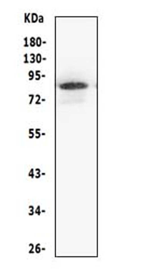 MCM5 Antibody - Western blot analysis of MCM5 using anti-MCM5 antibody. Electrophoresis was performed on a 5-20% SDS-PAGE gel at 70V (Stacking gel) / 90V (Resolving gel) for 2-3 hours. The sample well of each lane was loaded with 50ug of sample under reducing conditions. Lane 1: human Jurkat whole cell lysates, After Electrophoresis, proteins were transferred to a Nitrocellulose membrane at 150mA for 50-90 minutes. Blocked the membrane with 5% Non-fat Milk/ TBS for 1.5 hour at RT. The membrane was incubated with rabbit anti-MCM5 antigen affinity purified polyclonal antibody at 0.5 µg/mL overnight at 4°C, then washed with TBS-0.1% Tween 3 times with 5 minutes each and probed with a goat anti-rabbit IgG-HRP secondary antibody at a dilution of 1:10000 for 1.5 hour at RT. The signal is developed using an Enhanced Chemiluminescent detection (ECL) kit with Tanon 5200 system. A specific band was detected for MCM5 at approximately 82KD. The expected band size for MCM5 is at 82KD.