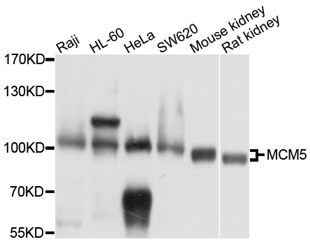 MCM5 Antibody - Western blot analysis of extracts of various cell lines.