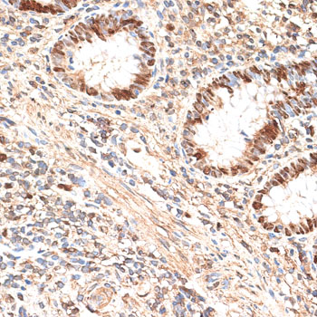 MCM5 Antibody - Immunohistochemistry of paraffin-embedded human appendix using MCM5 antibody at dilution of 1:100 (40x lens).