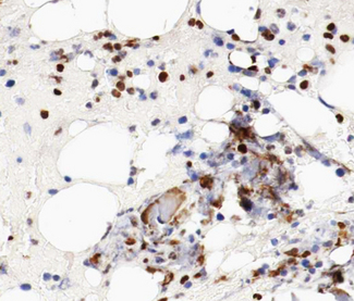 MCM5 Antibody - 1:100 staining human bone tissue by IHC-P. The tissue was formaldehyde fixed and a heat mediated antigen retrieval step in citrate buffer was performed. The tissue was then blocked and incubated with the antibody for 1.5 hours at 22 °C. An HRP conjugated goat anti-rabbit antibody was used as the secondary.