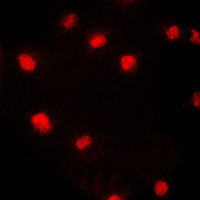 MCM5 Antibody - Immunofluorescent analysis of CDC46 staining in HeLa cells. Formalin-fixed cells were permeabilized with 0.1% Triton X-100 in TBS for 5-10 minutes and blocked with 3% BSA-PBS for 30 minutes at room temperature. Cells were probed with the primary antibody in 3% BSA-PBS and incubated overnight at 4 C in a humidified chamber. Cells were washed with PBST and incubated with a DyLight 594-conjugated secondary antibody (red) in PBS at room temperature in the dark. DAPI was used to stain the cell nuclei (blue).