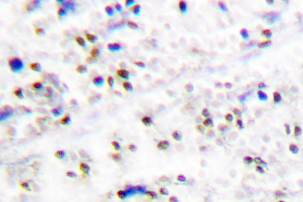 MCM5 Antibody - IHC of MCM5 (F51) pAb in paraffin-embedded human tonsil tissue.