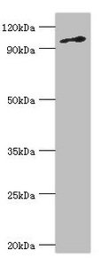 MCM6 Antibody - Western blot All lanes: DNA replication licensing factor MCM6 antibody at 3µg/ml + Jurkat whole cell lysate Secondary Goat polyclonal to rabbit IgG at 1/10000 dilution Predicted band size: 93 kDa Observed band size: 93 kDa