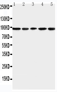 MCM6 Antibody - WB of MCM6 antibody. All lanes: Anti-MCM6 at 0.5ug/ml. Lane 1: U87 Whole Cell Lysate at 40ug. Lane 2: COLO320 Whole Cell Lysate at 40ug. Lane 3: HELA Whole Cell Lysate at 40ug. Lane 4: MCF-7 Whole Cell Lysate at 40ug. Lane 5: JURKAT Whole Cell Lysate at 40ug. Predicted bind size: 93KD. Observed bind size: 93KD.