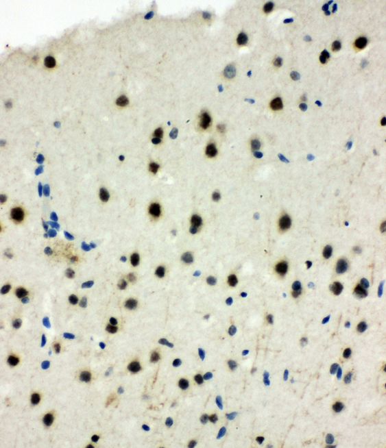 MCM6 Antibody - MCM6 antibody. IHC(P): Rat Brain Tissue.