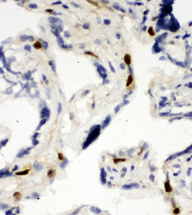MCM6 Antibody - MCM6 antibody. IHC(F): Human Placenta Tissue.