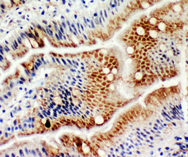 MCM6 Antibody - IHC analysis of MCM6 using anti-MCM6 antibody. MCM6 was detected in frozen section of rat intestine tissues. Heat mediated antigen retrieval was performed in citrate buffer (pH6, epitope retrieval solution) for 20 mins. The tissue section was blocked with 10% goat serum. The tissue section was then incubated with 1µg/ml rabbit anti-MCM6 Antibody overnight at 4°C. Biotinylated goat anti-rabbit IgG was used as secondary antibody and incubated for 30 minutes at 37°C. The tissue section was developed using Strepavidin-Biotin-Complex (SABC) with DAB as the chromogen.