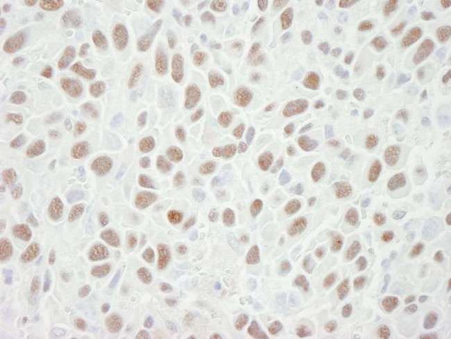 MCM6 Antibody - Detection of Mouse MCM6 by Immunohistochemistry. Sample: FFPE section of mouse squamous cell carcinoma. Antibody: Affinity purified goat anti-MCM6 used at a dilution of 1:250. Detection: DAB.