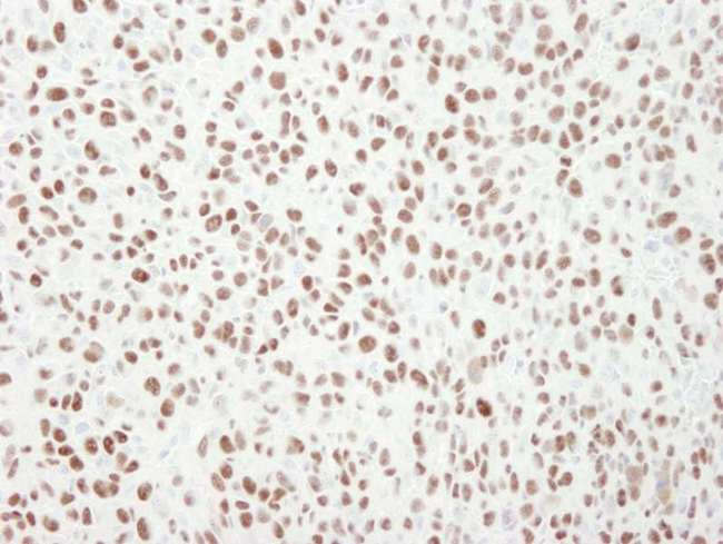 MCM6 Antibody - Detection of Mouse MCM6 by Immunohistochemistry. Sample: FFPE section of mouse squamous cell carcinoma. Antibody: Affinity purified rabbit anti-MCM6 used at a dilution of 1:250. Detection: DAB.