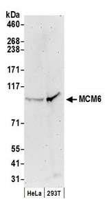 MCM6 Antibody - Detection of human MCM6 by western blot. Samples: Whole cell lysate (50 µg) from HeLa and HEK293T cells prepared using NETN lysis buffer. Antibody: Affinity purified goat anti-MCM6 antibody used for WB at 0.1 µg/ml. Detection: Chemiluminescence with an exposure time of 3 minutes.