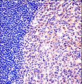 MCM6 Antibody - MCM6 Antibody immunohistochemistry of formalin-fixed and paraffin-embedded human tonsil tissue followed by peroxidase-conjugated secondary antibody and DAB staining.