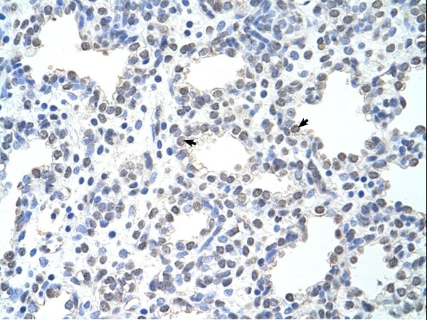 MCM6 Antibody - Human Lung.  This image was taken for the unconjugated form of this product. Other forms have not been tested.