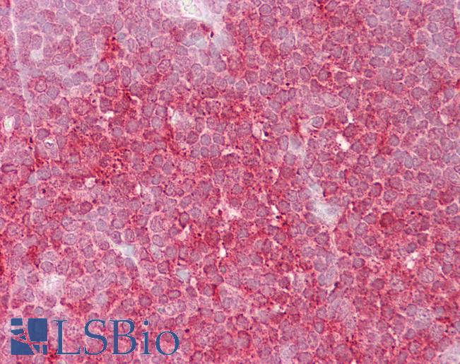 MCM6 Antibody - Anti-MCM6 antibody IHC of human thymus. Immunohistochemistry of formalin-fixed, paraffin-embedded tissue after heat-induced antigen retrieval. Antibody concentration 5 ug/ml.  This image was taken for the unconjugated form of this product. Other forms have not been tested.
