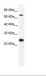 MCM6 Antibody - HepG2 Cell Lysate.  This image was taken for the unconjugated form of this product. Other forms have not been tested.
