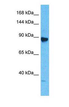 MCM6 Antibody - Western blot of MCM6 Antibody with human Jurkat Whole Cell lysate.  This image was taken for the unconjugated form of this product. Other forms have not been tested.