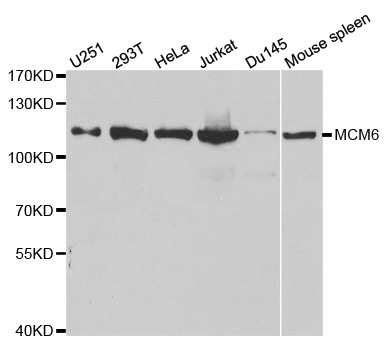 MCM6 Antibody - Western blot analysis of extracts of various cell lines.