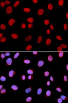 MCM6 Antibody - Immunofluorescence analysis of U2OS cells.