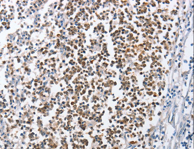 MCM6 Antibody - Immunohistochemistry of paraffin-embedded Human tonsil using MCM6 Polyclonal Antibody at dilution of 1:45.