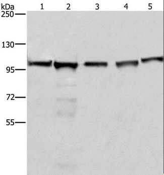 MCM6 Antibody - Western blot analysis of 293T, A549, Raji, K562 and NIH/3T3 cell, using MCM6 Polyclonal Antibody at dilution of 1:433.3.