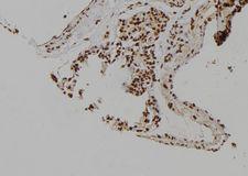 MCM6 Antibody - 1:100 staining rat lung tissue by IHC-P. The sample was formaldehyde fixed and a heat mediated antigen retrieval step in citrate buffer was performed. The sample was then blocked and incubated with the antibody for 1.5 hours at 22°C. An HRP conjugated goat anti-rabbit antibody was used as the secondary.