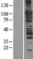 MCM6 Protein - Western validation with an anti-DDK antibody * L: Control HEK293 lysate R: Over-expression lysate