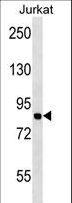 MCM7 Antibody - MCM7 Antibody western blot of Jurkat cell line lysates (35 ug/lane). The MCM7 antibody detected the MCM7 protein (arrow).