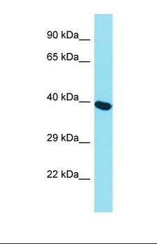 MCM7 Antibody - Western blot of Human Thyroid Tumor. MCM7 antibody dilution 1.0 ug/ml.  This image was taken for the unconjugated form of this product. Other forms have not been tested.