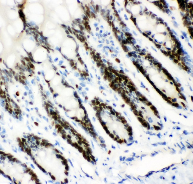 MCM7 Antibody - MCM7 antibody IHC-paraffin: Rat Intestine Tissue.