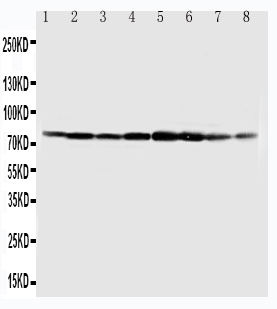 MCM7 Antibody - WB of MCM7 antibody. All lanes: Anti-MCM7 at 0.5ug/ml. Lane 1: COLO320 Whole Cell Lysate at 40ug. Lane 2: SW620 Whole Cell Lysate at 40ug. Lane 3: HELA Whole Cell Lysate at 40ug. Lane 4: 22RVL Whole Cell Lysate at 40ug. Lane 5: 293T Whole Cell Lysate at 40ug. Lane 6: U937 Whole Cell Lysate at 40ug. Lane 7: JURKAT Whole Cell Lysate at 40ug. Lane 8: RAJI Whole Cell Lysate at 40ug. Predicted bind size: 81KD. Observed bind size: 81KD.