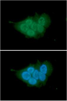 MCM7 Antibody - ICC/IF analysis of MCM7 in MCF7 cells. The cell was stained with MCM7 antibody (1:100).The secondary antibody (green) was used Alexa Fluor 488. DAPI was stained the cell nucleus (blue).