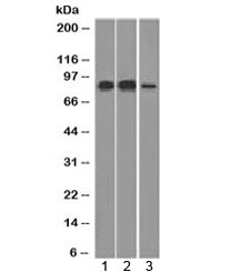 MCM7 Antibody - Western blot testing of human 1) HeLa, 2) Raji and 3) HepG2 cell lysate with MCM7 antibody (clone MCM7/1466). Expected molecular weight: 80-90 kDa.