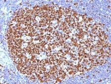 MCM7 Antibody - IHC testing of FFPE human tonsil with MCM7 antibody (clone MCM7/1466). Required HIER: boil tissue sections in 10mM citrate buffer, pH 6, for 10-20 min.