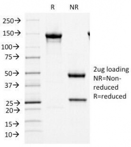 MCM7 Antibody - SDS-PAGE Analysis of Purified, BSA-Free MCM7 Antibody (clone MCM7/1466). Confirmation of Integrity and Purity of the Antibody.