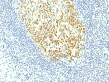 MCM7 Antibody - IHC testing of FFPE human tonsil with MCM7 antibody (clone MCM7/1467). Required HIER: boil tissue sections in 10mM citrate buffer, pH 6, for 10-20 min.
