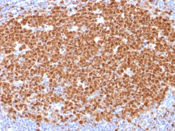 MCM7 Antibody - IHC testing of FFPE human tonsil with MCM7 antibody (clone MCM7/1468). Required HIER: boil tissue sections in 10mM citrate buffer, pH 6, for 10-20 min.