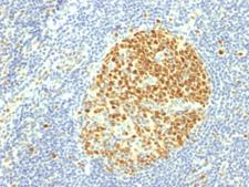 MCM7 Antibody - IHC testing of FFPE human tonsil with MCM7 antibody (clone MCM7/1469). Required HIER: boil tissue sections in 10mM citrate buffer, pH 6, for 10-20 min.