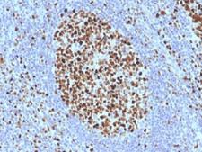 MCM7 Antibody - IHC testing of FFPE human tonsil with MCM7 antibody (clone SPM379). Required HIER: boil tissue sections in 10mM citrate buffer, pH 6, for 10-20 min.