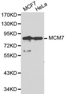 MCM7 Antibody - Western blot of MCM7 pAb in extracts from MCF7 and Hela cells.