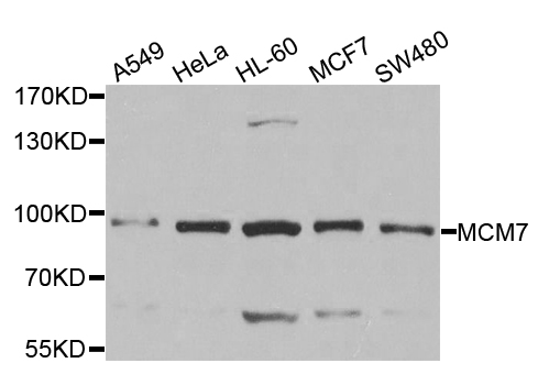 MCM7 Antibody - Western blot analysis of extracts of various cell lines, using MCM7 antibody at 1:1000 dilution. The secondary antibody used was an HRP Goat Anti-Rabbit IgG (H+L) at 1:10000 dilution. Lysates were loaded 25ug per lane and 3% nonfat dry milk in TBST was used for blocking. An ECL Kit was used for detection and the exposure time was 10s.
